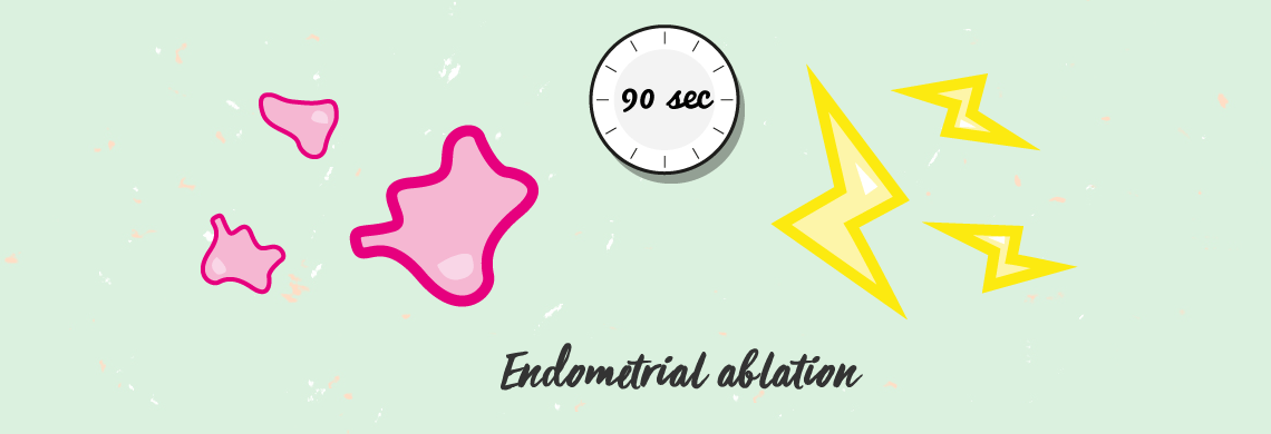 Endometrial ablation. What’s that?