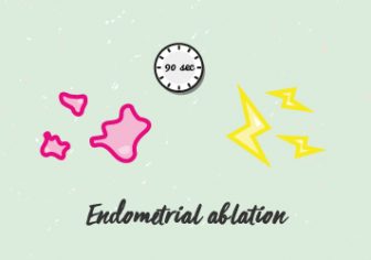 Endometrial ablation. What’s that?