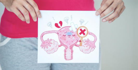 Signs Your Period Is Telling You Something Is Wrong